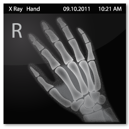X Ray Hand Icon Vista Medical Icons Softicons Com